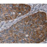 Immunohistochemistry - REG4 Antibody from Signalway Antibody (40321) - Antibodies.com