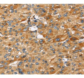 Immunohistochemistry - STC2 Antibody from Signalway Antibody (40339) - Antibodies.com