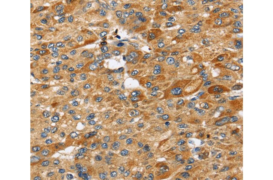 Immunohistochemistry - STC2 Antibody from Signalway Antibody (40339) - Antibodies.com