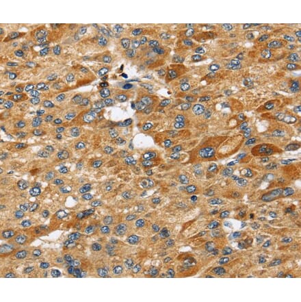 Immunohistochemistry - STC2 Antibody from Signalway Antibody (40339) - Antibodies.com