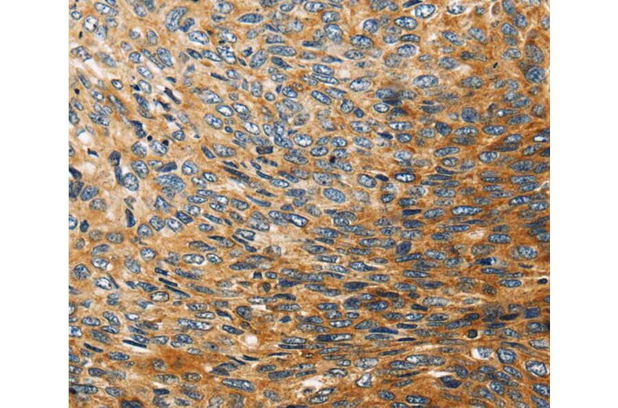 Immunohistochemistry - STC2 Antibody from Signalway Antibody (40339) - Antibodies.com