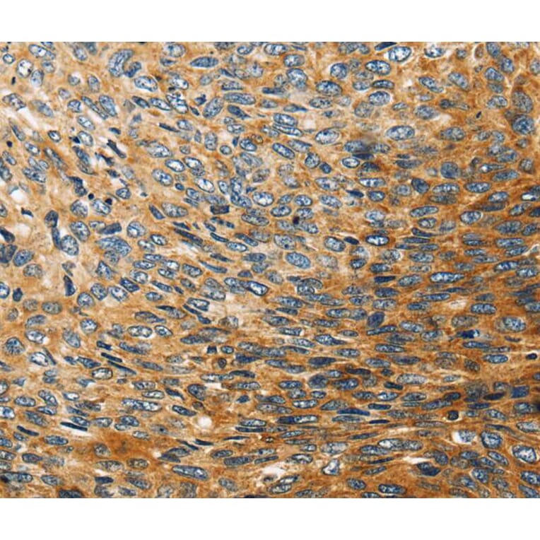 Immunohistochemistry - STC2 Antibody from Signalway Antibody (40339) - Antibodies.com