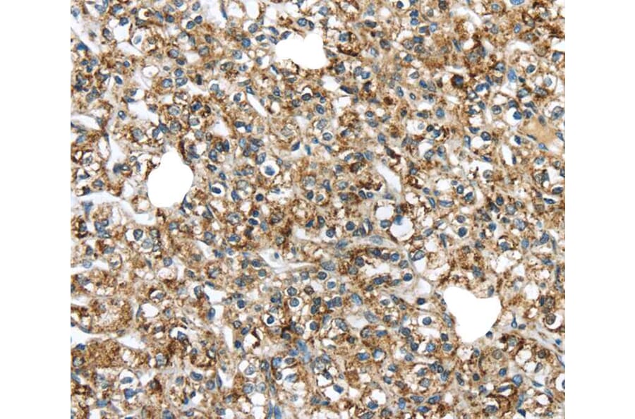 Immunohistochemistry - TGM4 Antibody from Signalway Antibody (40348) - Antibodies.com