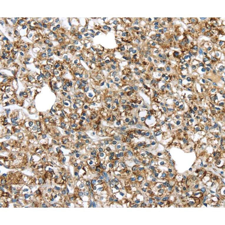 Immunohistochemistry - TGM4 Antibody from Signalway Antibody (40348) - Antibodies.com