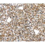 Immunohistochemistry - TGM4 Antibody from Signalway Antibody (40348) - Antibodies.com