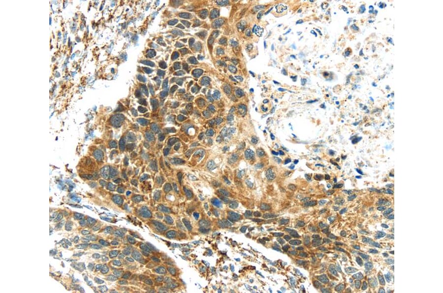 Immunohistochemistry - TGM4 Antibody from Signalway Antibody (40348) - Antibodies.com