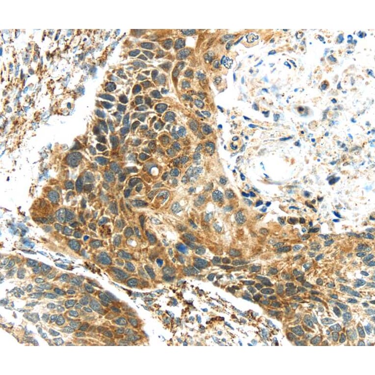 Immunohistochemistry - TGM4 Antibody from Signalway Antibody (40348) - Antibodies.com