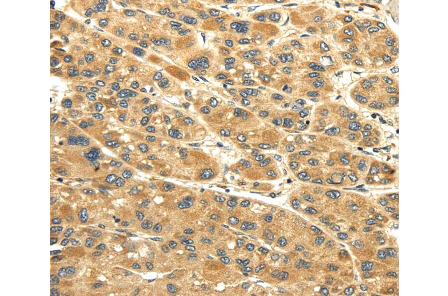 Immunohistochemistry - UACA Antibody from Signalway Antibody (40351) - Antibodies.com