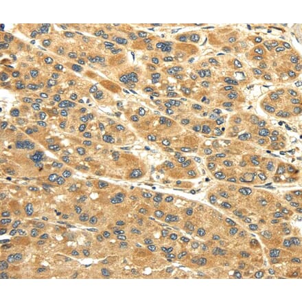 Immunohistochemistry - UACA Antibody from Signalway Antibody (40351) - Antibodies.com
