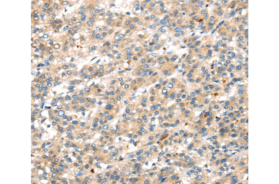 Immunohistochemistry - DDK1 Antibody from Signalway Antibody (40397) - Antibodies.com