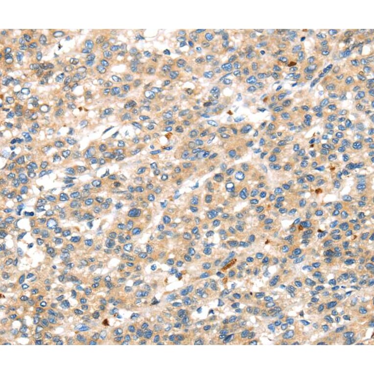 Immunohistochemistry - DDK1 Antibody from Signalway Antibody (40397) - Antibodies.com