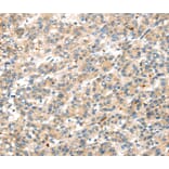 Immunohistochemistry - DDK1 Antibody from Signalway Antibody (40397) - Antibodies.com