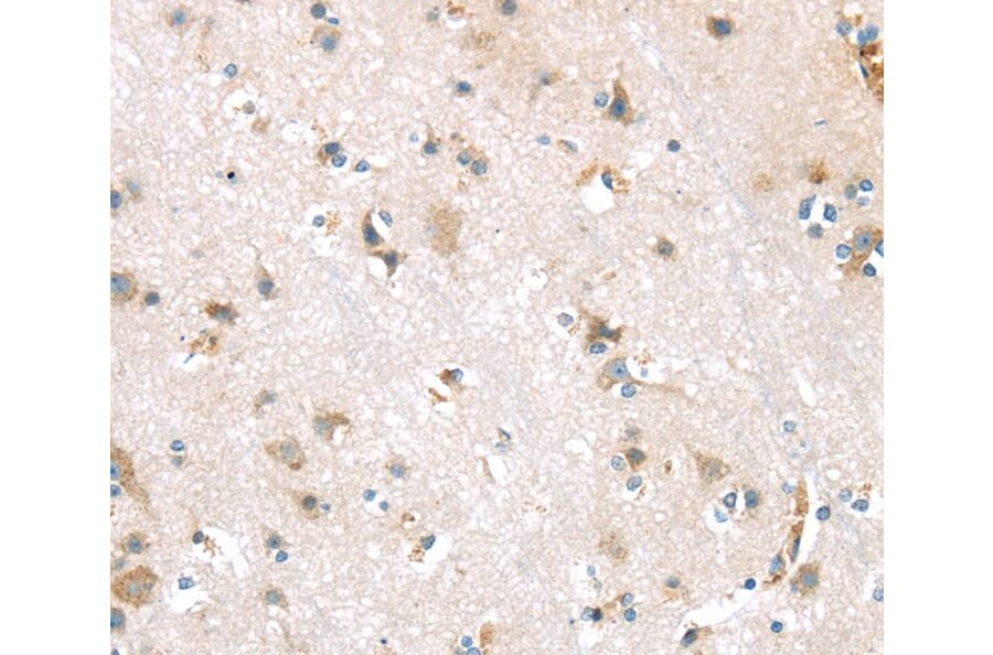 Immunohistochemistry - DDK1 Antibody from Signalway Antibody (40397) - Antibodies.com