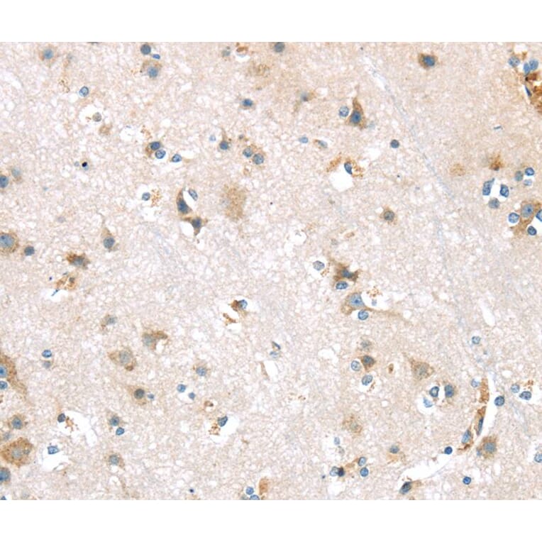 Immunohistochemistry - DDK1 Antibody from Signalway Antibody (40397) - Antibodies.com