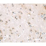 Immunohistochemistry - DDK1 Antibody from Signalway Antibody (40397) - Antibodies.com