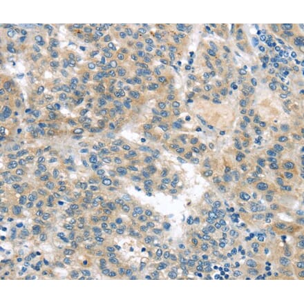 Immunohistochemistry - VAV2 Antibody from Signalway Antibody (40401) - Antibodies.com