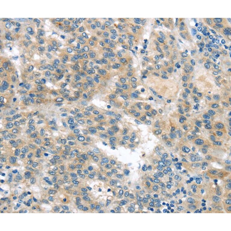 Immunohistochemistry - VAV2 Antibody from Signalway Antibody (40401) - Antibodies.com