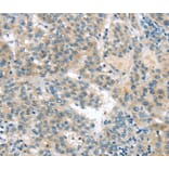 Immunohistochemistry - VAV2 Antibody from Signalway Antibody (40401) - Antibodies.com
