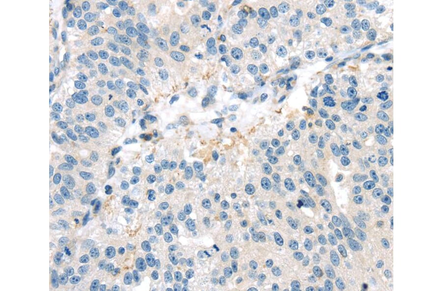 Immunohistochemistry - VAV2 Antibody from Signalway Antibody (40401) - Antibodies.com