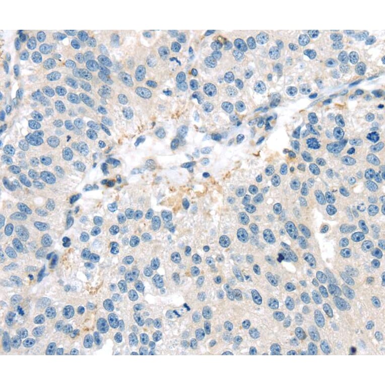 Immunohistochemistry - VAV2 Antibody from Signalway Antibody (40401) - Antibodies.com