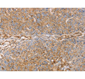 Immunohistochemistry - GFAP Antibody from Signalway Antibody (42704) - Antibodies.com
