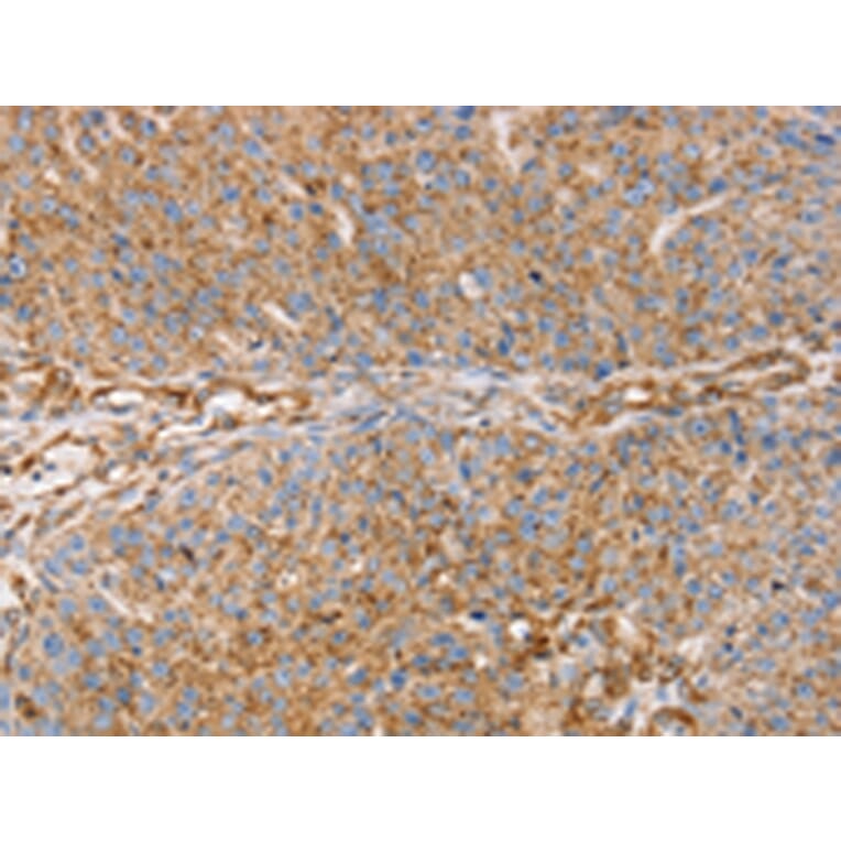Immunohistochemistry - GFAP Antibody from Signalway Antibody (42704) - Antibodies.com