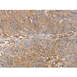 Immunohistochemistry - GFAP Antibody from Signalway Antibody (42704) - Antibodies.com