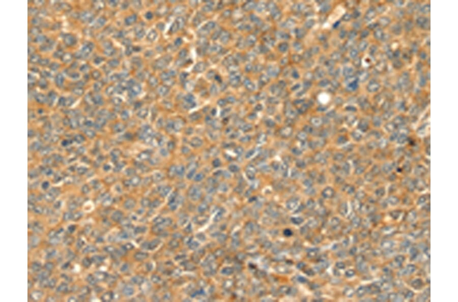 Immunohistochemistry - GRB2 Antibody from Signalway Antibody (42705) - Antibodies.com