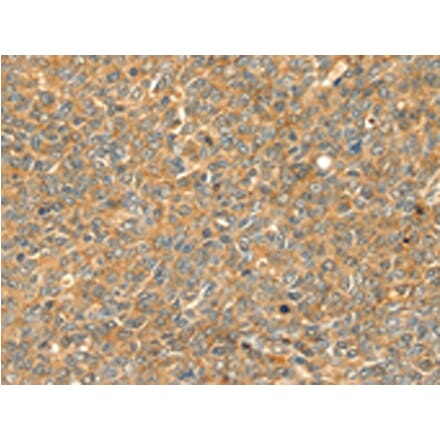 Immunohistochemistry - GRB2 Antibody from Signalway Antibody (42705) - Antibodies.com