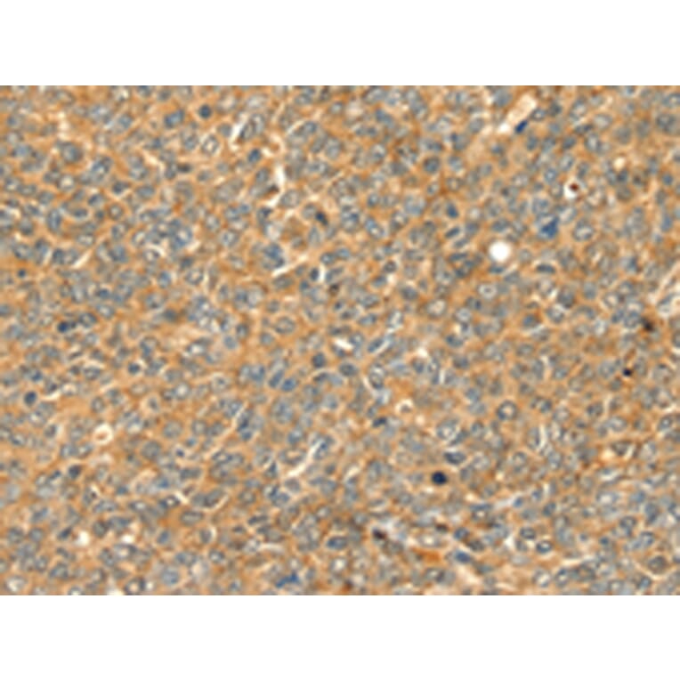 Immunohistochemistry - GRB2 Antibody from Signalway Antibody (42705) - Antibodies.com