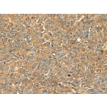 Immunohistochemistry - GRB2 Antibody from Signalway Antibody (42705) - Antibodies.com