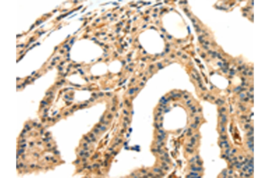 Immunohistochemistry - GRB2 Antibody from Signalway Antibody (42705) - Antibodies.com