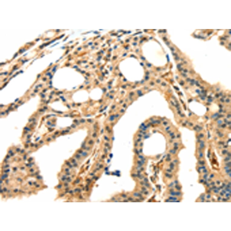 Immunohistochemistry - GRB2 Antibody from Signalway Antibody (42705) - Antibodies.com