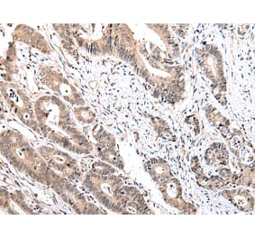 Immunohistochemistry - IL15 Antibody from Signalway Antibody (42710) - Antibodies.com