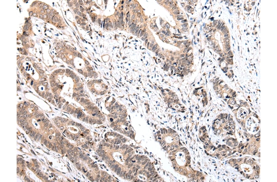 Immunohistochemistry - IL15 Antibody from Signalway Antibody (42710) - Antibodies.com