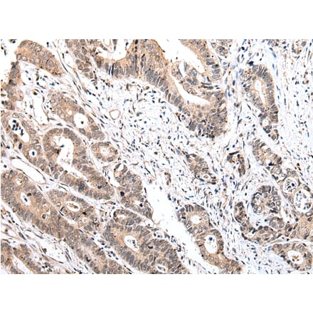 Immunohistochemistry - IL15 Antibody from Signalway Antibody (42710) - Antibodies.com
