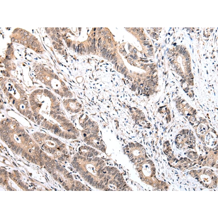 Immunohistochemistry - IL15 Antibody from Signalway Antibody (42710) - Antibodies.com