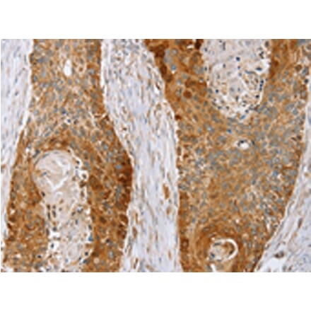 Immunohistochemistry - LMO4 Antibody from Signalway Antibody (42719) - Antibodies.com