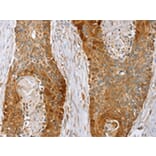 Immunohistochemistry - LMO4 Antibody from Signalway Antibody (42719) - Antibodies.com