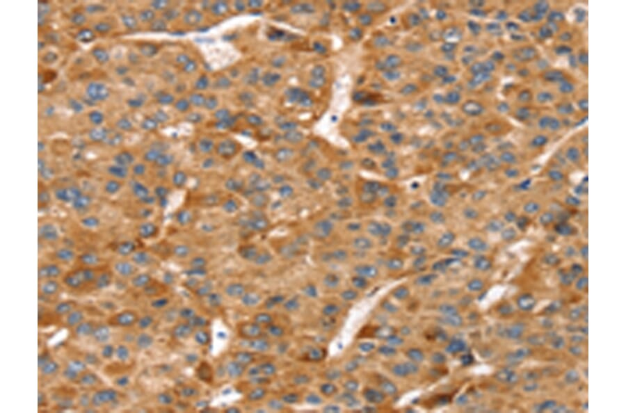 Immunohistochemistry - RFFL Antibody from Signalway Antibody (42731) - Antibodies.com