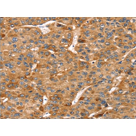 Immunohistochemistry - RFFL Antibody from Signalway Antibody (42731) - Antibodies.com