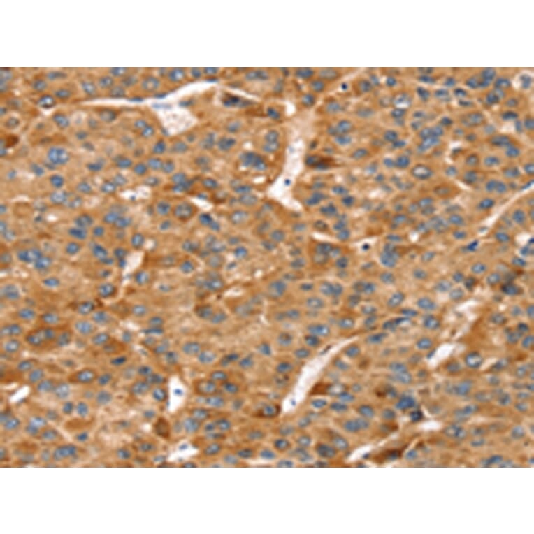 Immunohistochemistry - RFFL Antibody from Signalway Antibody (42731) - Antibodies.com