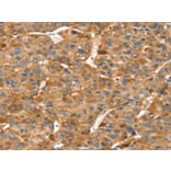 Immunohistochemistry - RFFL Antibody from Signalway Antibody (42731) - Antibodies.com