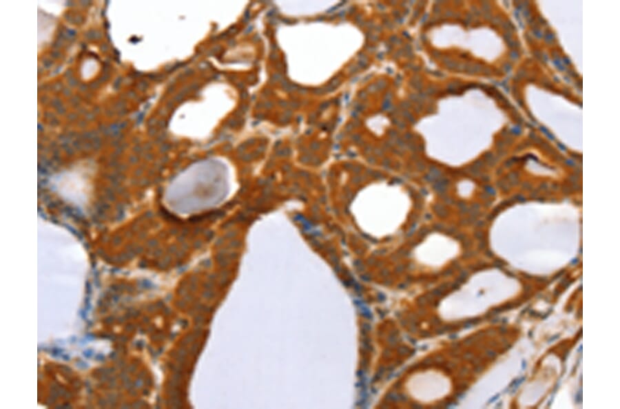 Immunohistochemistry - RGS5 Antibody from Signalway Antibody (42732) - Antibodies.com