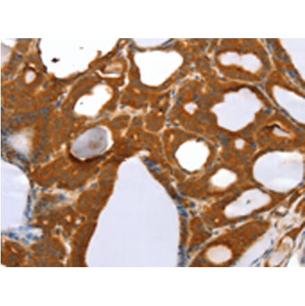 Immunohistochemistry - RGS5 Antibody from Signalway Antibody (42732) - Antibodies.com