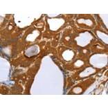Immunohistochemistry - RGS5 Antibody from Signalway Antibody (42732) - Antibodies.com