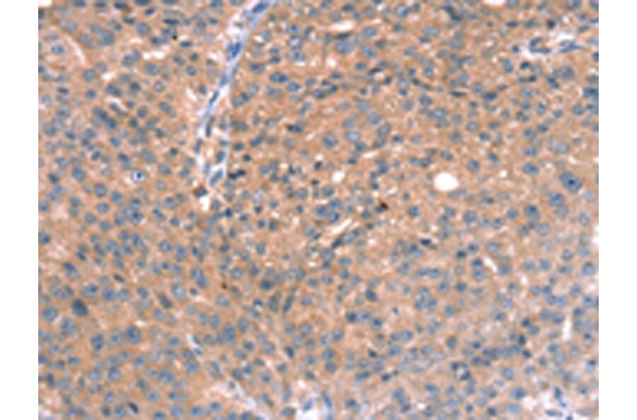 Immunohistochemistry - RGS5 Antibody from Signalway Antibody (42732) - Antibodies.com