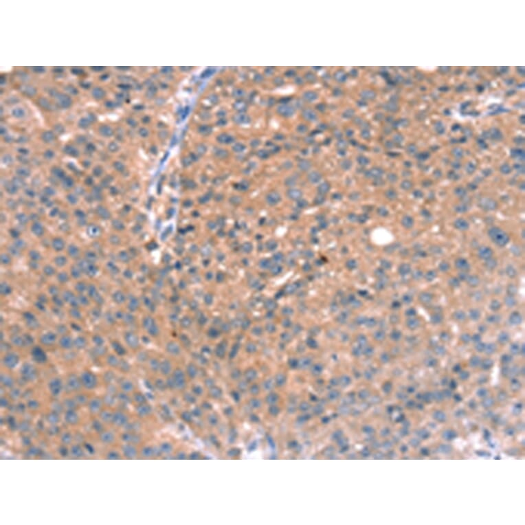 Immunohistochemistry - RGS5 Antibody from Signalway Antibody (42732) - Antibodies.com