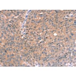 Immunohistochemistry - RGS5 Antibody from Signalway Antibody (42732) - Antibodies.com