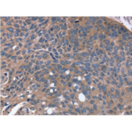 Immunohistochemistry - RGS4 Antibody from Signalway Antibody (42733) - Antibodies.com
